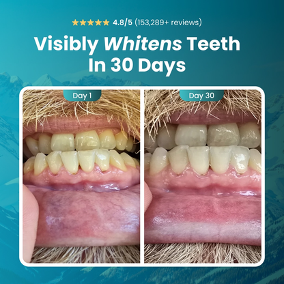 Mastic Mint Remineralizing Gum